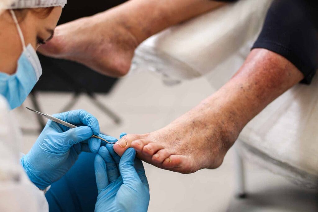 Care home footcare services in and around Rotherham, Sheffield and Doncaster